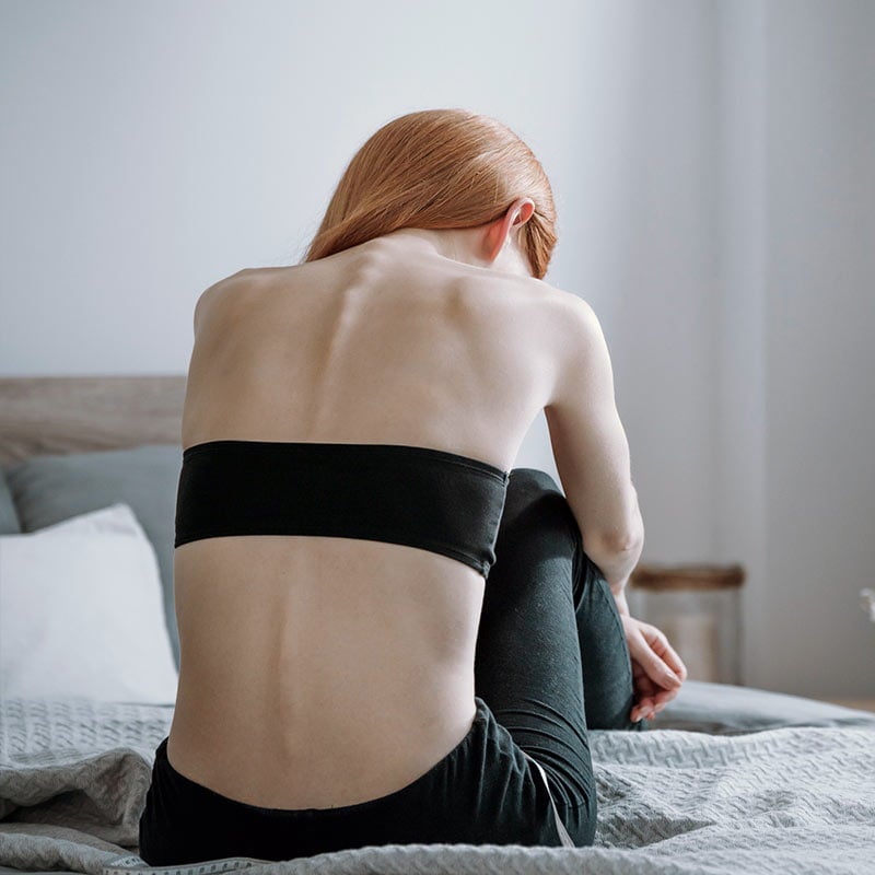 Anorexia